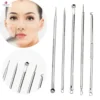 EXTRACTOR DE IMPERFECCIONES